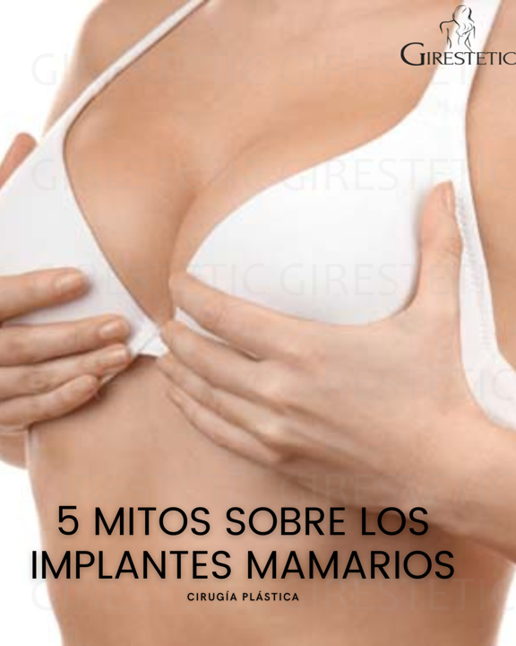 5 Mitos Sobre Los Implantes Mamarios – Girestetic